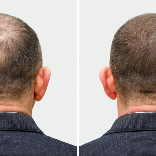 before-after1.jpg