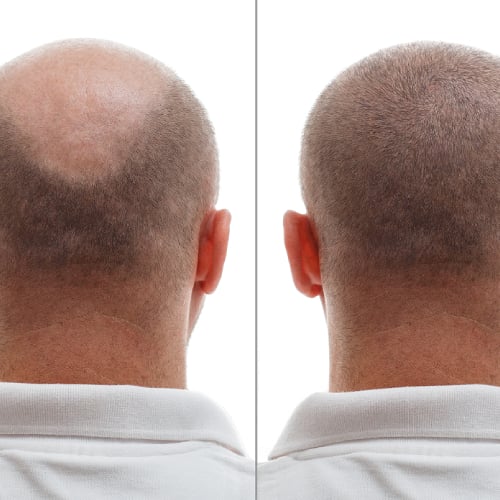 before-after2.jpg