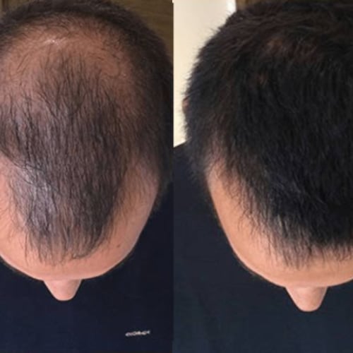 before.jpg
